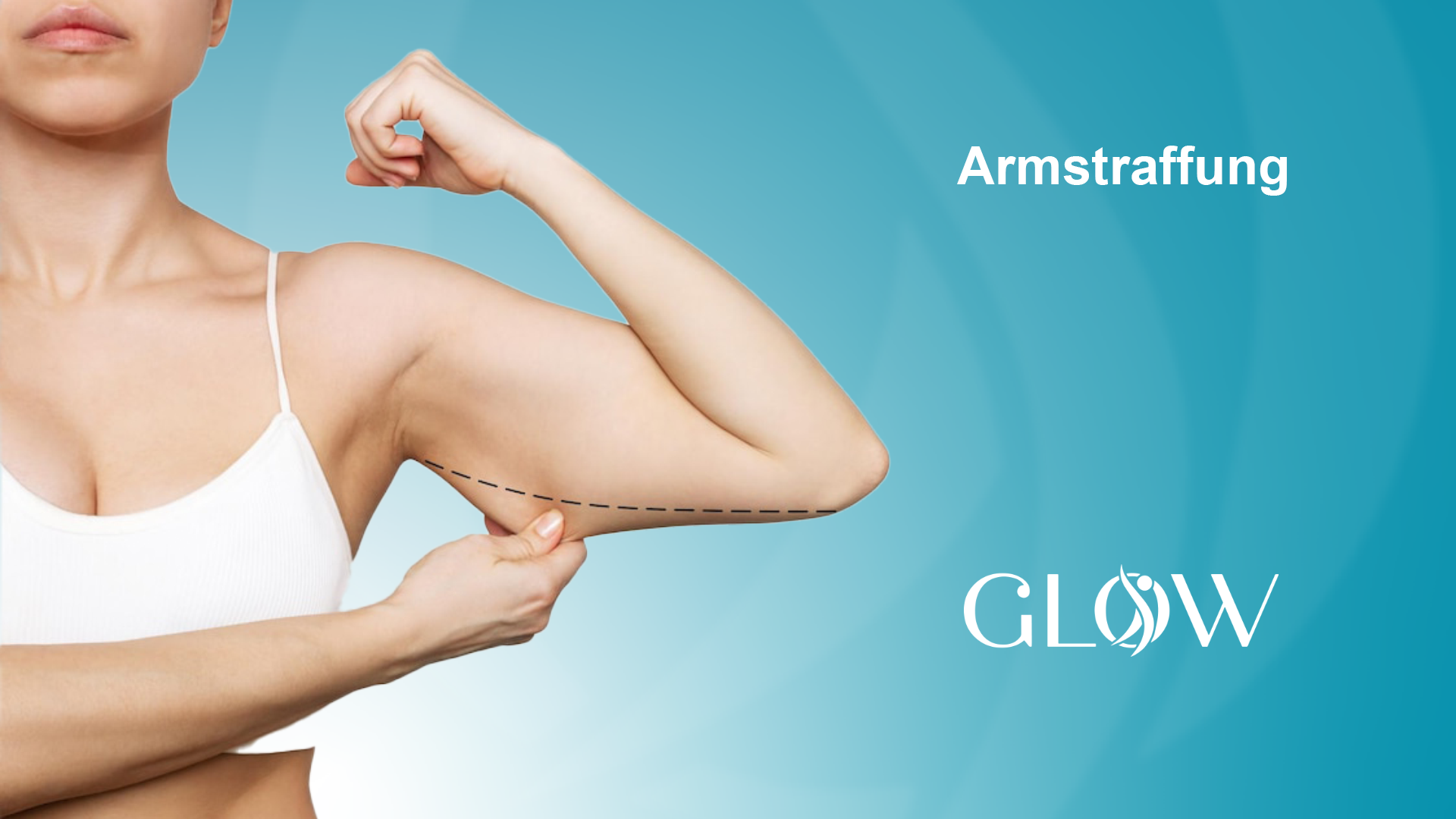 Armstraffung