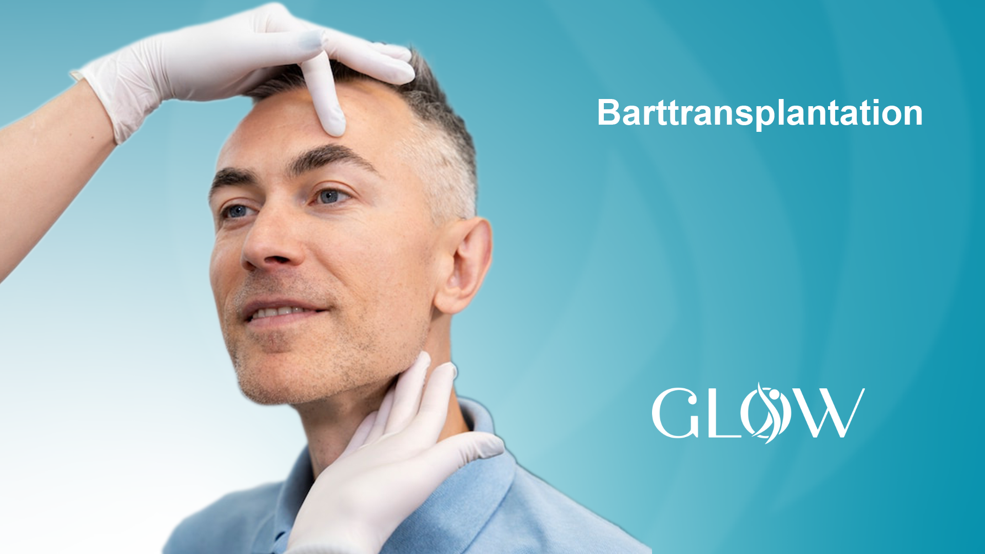 Barttransplantation